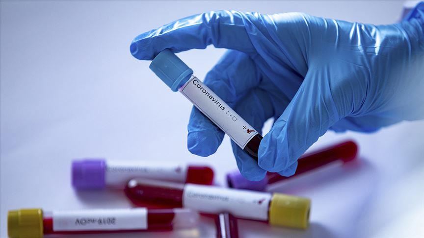 Якутские лаборатории вышли на показатель 1200-1400 исследований по выявлению коронавируса