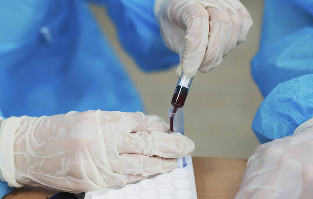 В Якутии зарегистрировано 135 случаев заболевания коронавирусом