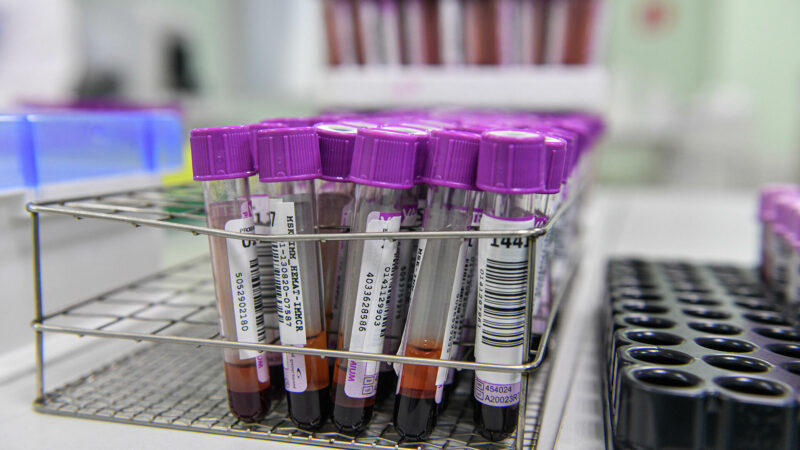 На 10 марта в Якутии за сутки выявили 36 новых случаев коронавируса