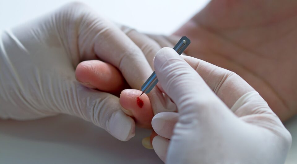 В Якутске проведут бесплатное тестирование на ВИЧ-инфекцию и вирусные гепатиты