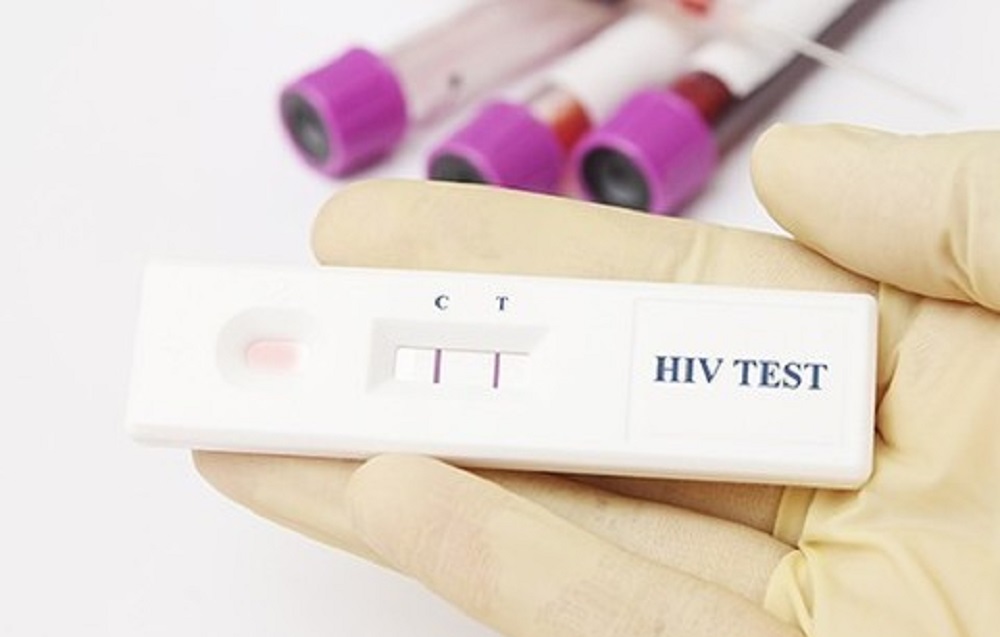 Экспресс-тестирование на ВИЧ-инфекцию и гепатиты пройдет в Якутске с 1 по 4 декабря