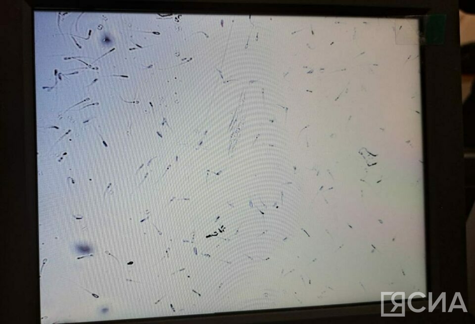 Так выглядят под микроскопом ожившие после разморозки 